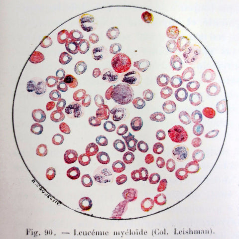 Antique 1912 Medical Blood Diseases Book by Dopter, 92 illustrations, Baillière