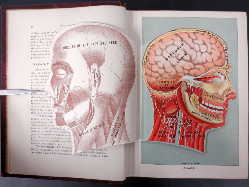 Antique Medical Book 1903, Medicology Encyclopedia, Illustrated Unfolding Plates