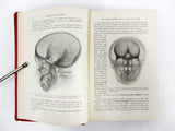 Antique 1916 Medical Book on External Pathology by J. Okinczyc, 164 Drawings