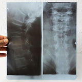 Vintage Genuine Medical X-Ray 10X11" of a Patient's Neck Cervical Vertebrae, Human Skeleton X-Ray on Dupont Chronex Thick Plastic Sheet