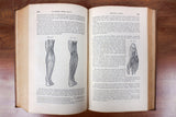Antique 1856 Human Anatomy Dissection Illustrated Medical Book by Doctor Erasmus Wilson, 251 Illustrations by Gilbert, Blanchard and Lea