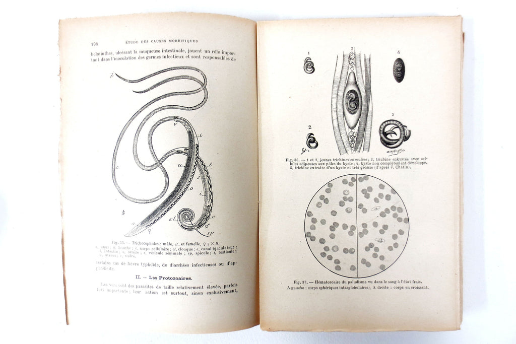 Antique Illustrated Medical Book, Genetic Diseases & Disorders, Dr Libert, Paris